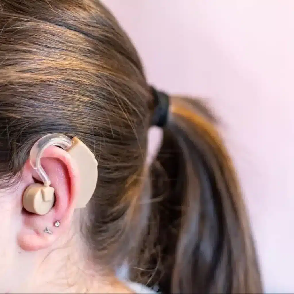 Close-up view of a woman wearing a cochlear implant behind her ear.