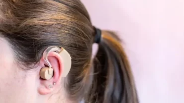 Close-up view of a woman wearing a cochlear implant behind her ear.
